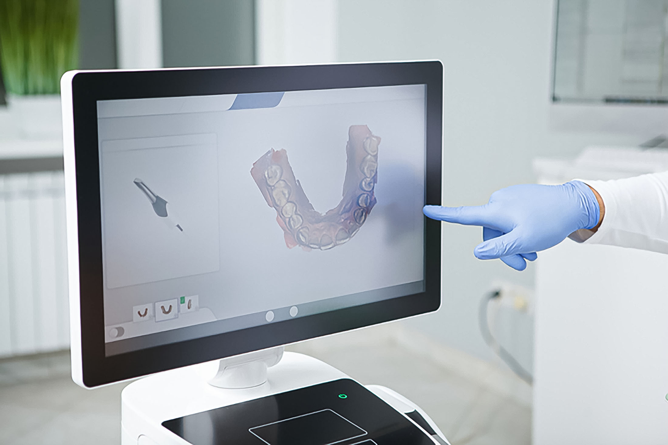 Dentalscanner Bildschirm Behandlung